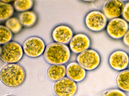 Matured Chlamydomonas spore