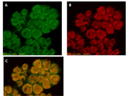 共焦点レーザー顕微鏡によるBotryococcus brauniiの観察像